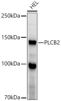 Western Blot: Phospholipase C beta 2 Antibody [NBP2-93815] - Western blot analysis of extracts of HEL cells, using Phospholipase C beta 2 antibody (NBP2-93815) at 1:1000 dilution. Secondary antibody: HRP Goat Anti-Rabbit IgG (H+L) at 1:10000 dilution. Lysates/proteins: 25ug per lane. Blocking buffer: 3% nonfat dry milk in TBST. Detection: ECL Enhanced Kit. Exposure time: 90s.